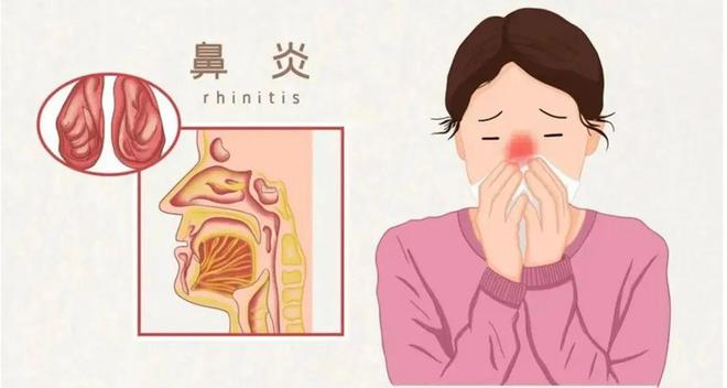 漫天飞舞的飞絮还将持续一个月!解决鼻过敏,推荐这几个中医方法 漫天飞舞的飞絮还将持续一个月!解决鼻过敏,推荐这几个中医方法